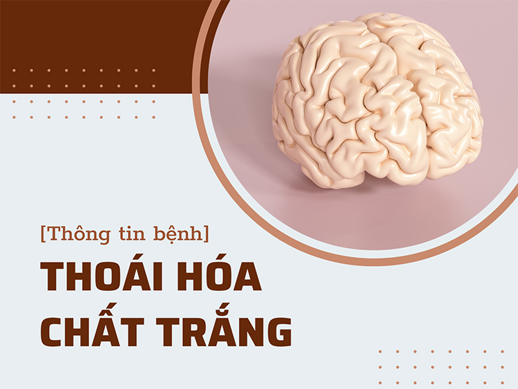 1. Tổng Quan Về Thoái Hóa Chất Trắng