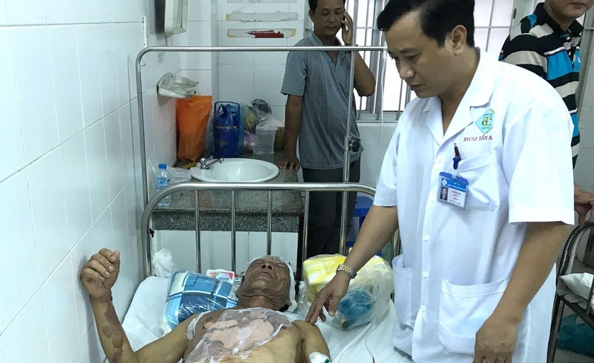 Nạn nhân trong vụ bỏng cồn đang được cấp cứu tại Bệnh viện 