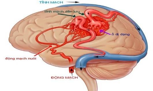 Mắc bệnh này, bạn có nguy cơ đột tử trước tuổi 40