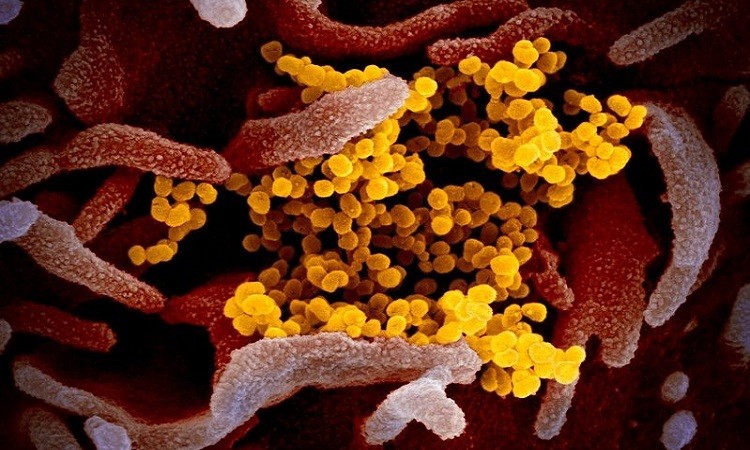 nCoV (màu vàng) khu trú giữa các tế bào cơ thể người (màu hồng). Ảnh: RML.