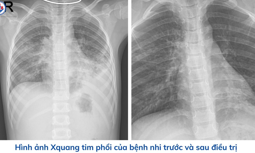 Ảnh: Bệnh viện Sản Nhi Nghệ An 