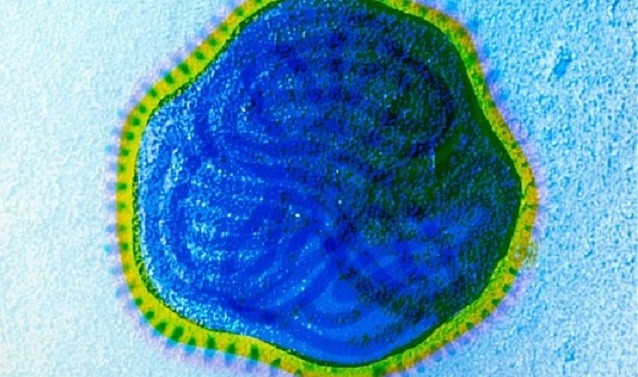 Khối u nhỏ dần lại trong 36 giờ sau tiêm virus sởi 