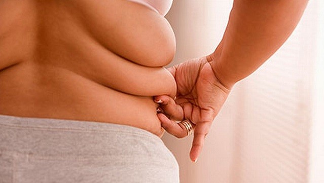 Phụ nữ béo phì tăng nguy cơ thoái hóa khớp gối