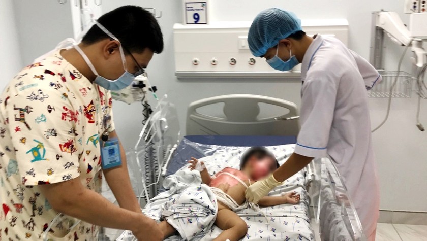 Bé trai 18 tháng tuổi, phỏng nặng, được xử trí tích cực tại Khoa cấp cứu. Ảnh: BVCC
