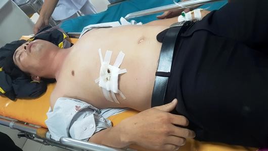 Thầy giáo Ng.V.T với vết thương ở bụng khi cấp cứu tại bệnh viện.