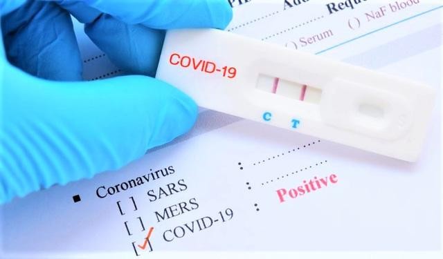 Đề xuất đưa mặt hàng test virus SARS-CoV-2 vào diện bình ổn giá hoặc danh mục kê khai giá. 