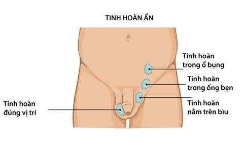 Ảnh minh họa - Nguồn: BVCC