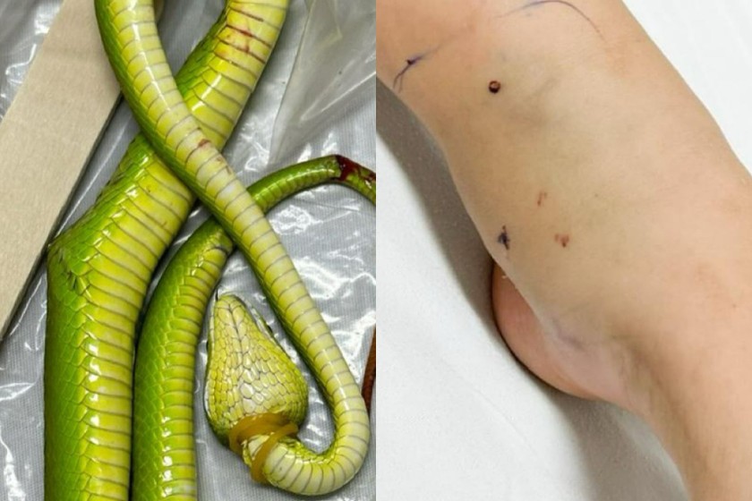 Hình ảnh con rắn lục đuôi đỏ và vết cắn của nạn nhân.
