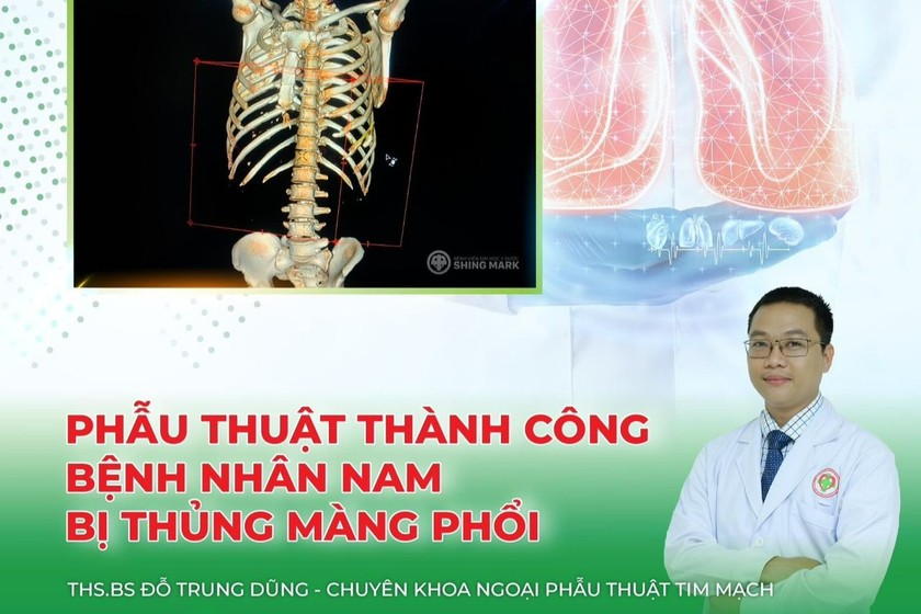 Cứu thành công bệnh nhân bị gãy xương sườn