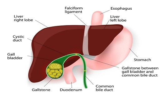 Chủ tịch Hội gan mật Việt Nam giải đáp thắc mắc bệnh sỏi mật