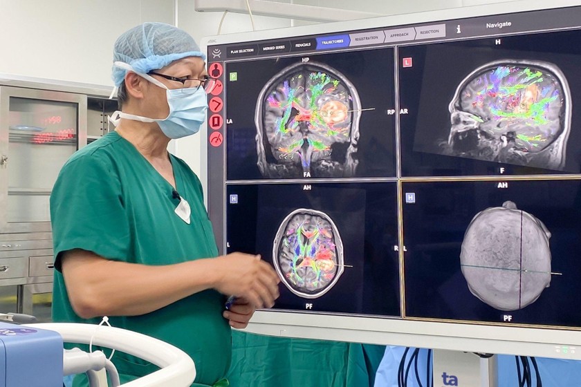 Robot AI hòa hình MRI, DTI.. cho thấy rõ các bó sợi thần kinh và khối máu tụ chèn ép trong não người bệnh. (Ảnh: Nguyễn Trăm)