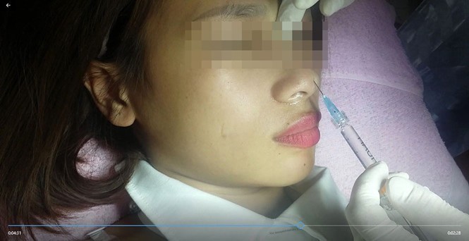 Chị Loan đang được bà H. tiêm filler