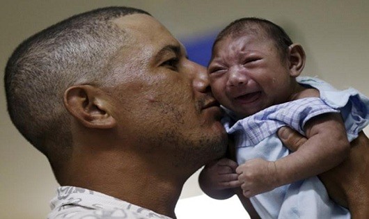 Trẻ em là nạn nhân của virus Zika. 