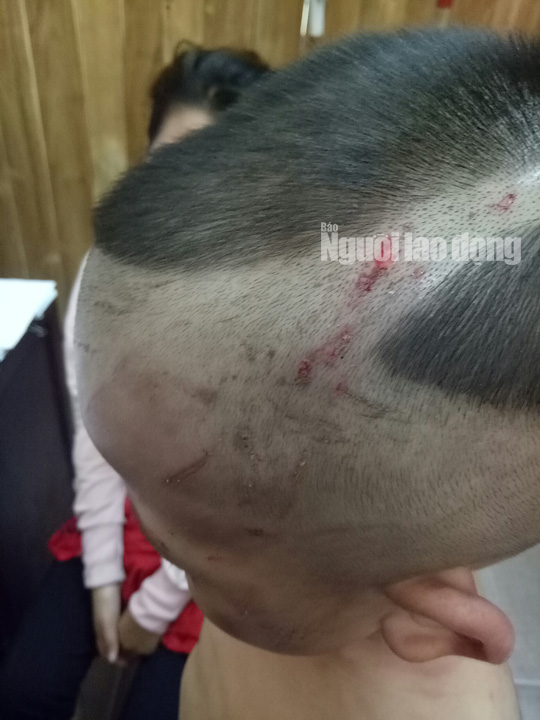 Giải cứu bé trai 3 tuổi bị cha dượng đánh dã man ở Phú Quốc - Ảnh 3. Giải cứu bé trai 3 tuổi bị cha dượng đánh dã man ở Phú Quốc - Ảnh 3.