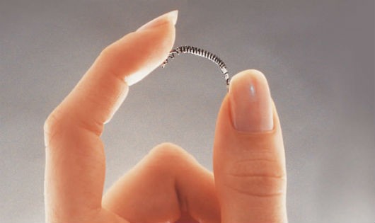 Hình ảnh thiết bị tránh thai Essure