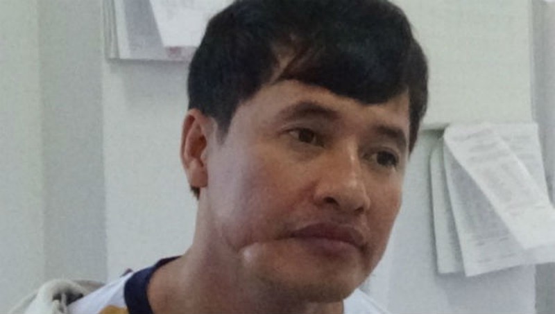 Bị can Nguyễn Phi Hùng