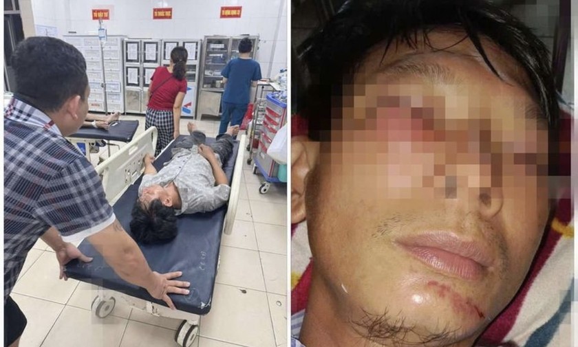 Theo người nhà anh H, hiện anh H vẫn trong tình trạng choáng váng, đang được theo dõi tại Bệnh viện Đa khoa tỉnh Hà Tĩnh, các bác sỹ đang tiếp tục cho chụp chiếu để kiểm tra tổn thương.