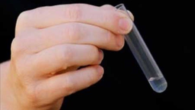Vasalgel là một "hợp chất hyđrogel cao phân tử" tiêm vào ống dẫn tinh để ngăn cản tinh trùng, giúp chặn đứng việc thụ thai. Ảnh: Haelth News