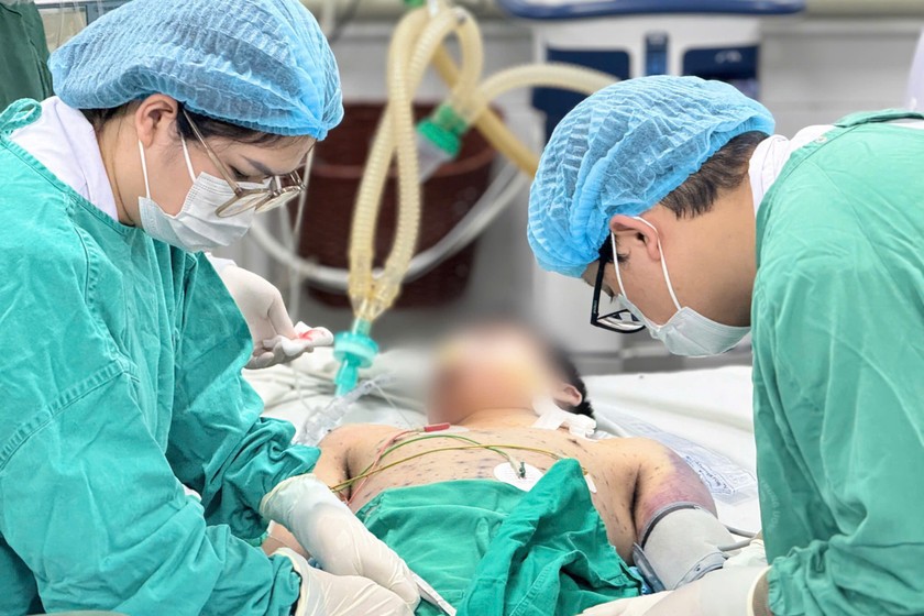 Bệnh nhân trẻ mắc thuỷ đậu dù không có bệnh nền nhưng vẫn nhanh chóng rơi vào tình trạng nguy kịch, tiên lượng xấu. Ảnh: Thanh Thanh