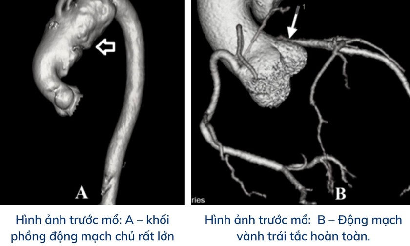 Hình ảnh chụp cho thấy tình trạng của bệnh nhân. Ảnh: BVCC