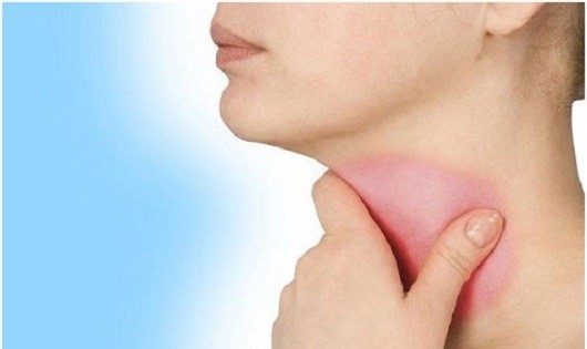 10 mẹo trị viêm họng nhanh chóng và hiệu quả nhất