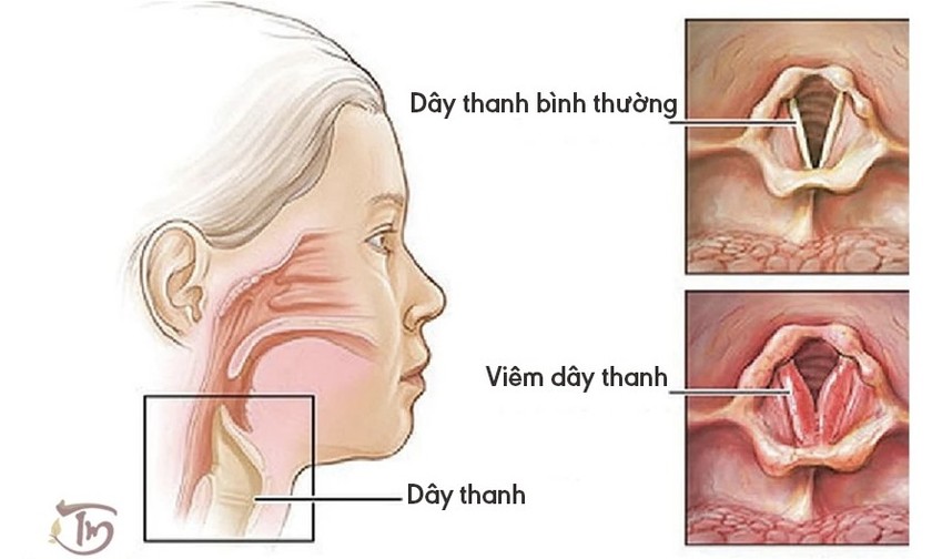 Hình minh họa. Nguồn ảnh internet