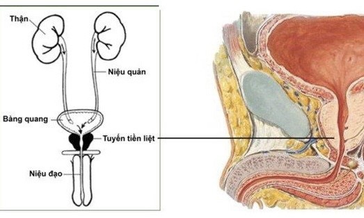 Hình minh họa. Nguồn ảnh internet