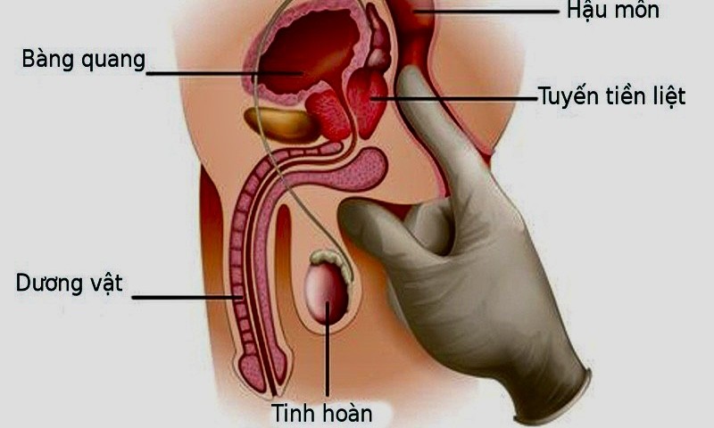 Hình minh họa, nguồn internet