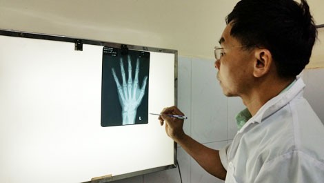 Giám định viên thao tác nghiệp vụ một vụ giám định xương. 