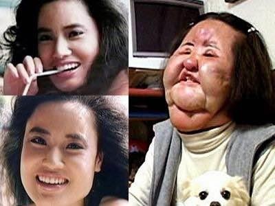 Không ít mỹ nhân gặp đại họa sau khi phẫu thuật thẩm mỹ. 