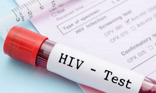 Xét nghiệm HIV sớm giúp người bệnh tăng cơ hội điều trị.  (Ảnh minh họa)